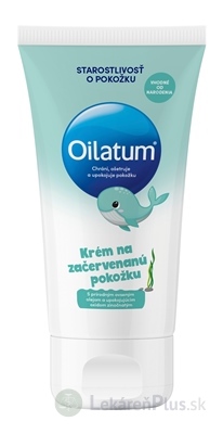 Oilatum krém na začervenanú pokožku 1x100 ml